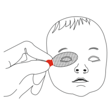 ACSmed Eye Safety Tape Pediatric