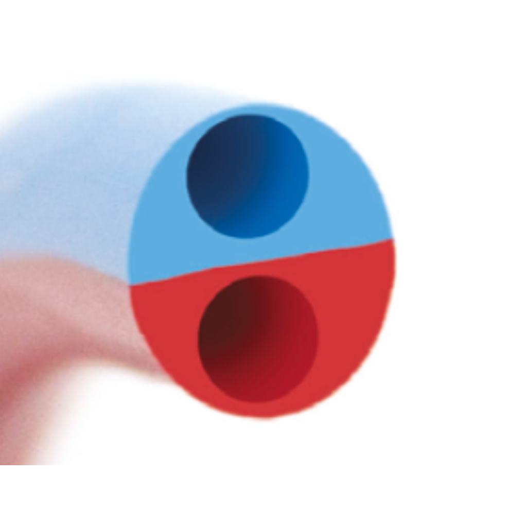 Kimal ALTIUS ® RT Acute Renal Catheter