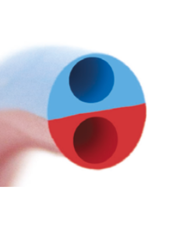 ALTIUS ® RT Acute Renal Catheter 10 stuks