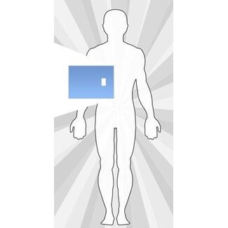 SorbX™  Multi-Purpose Shield with Fenestration