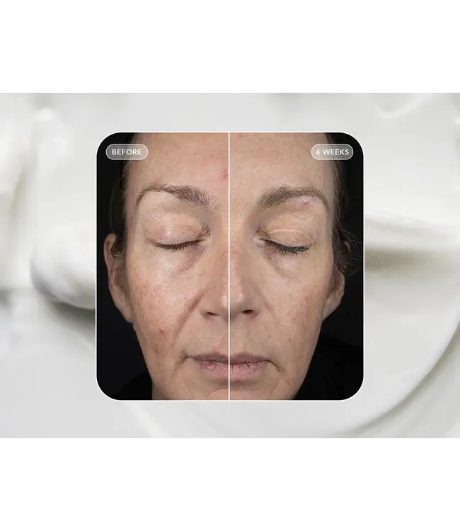 Image Skincare VOL.U.LIFT 4D Skin Rebound Complex