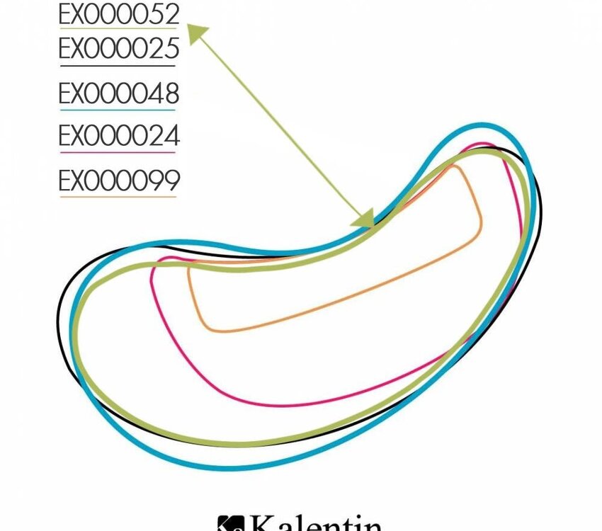 Kalentin Aloe & Vitamin C Eye Pads 30pk