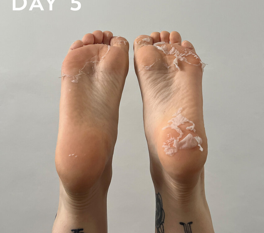 Hive Maskology Foot Peel Treatment Mask