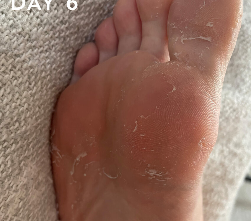 Hive Maskology Foot Peel Treatment Mask