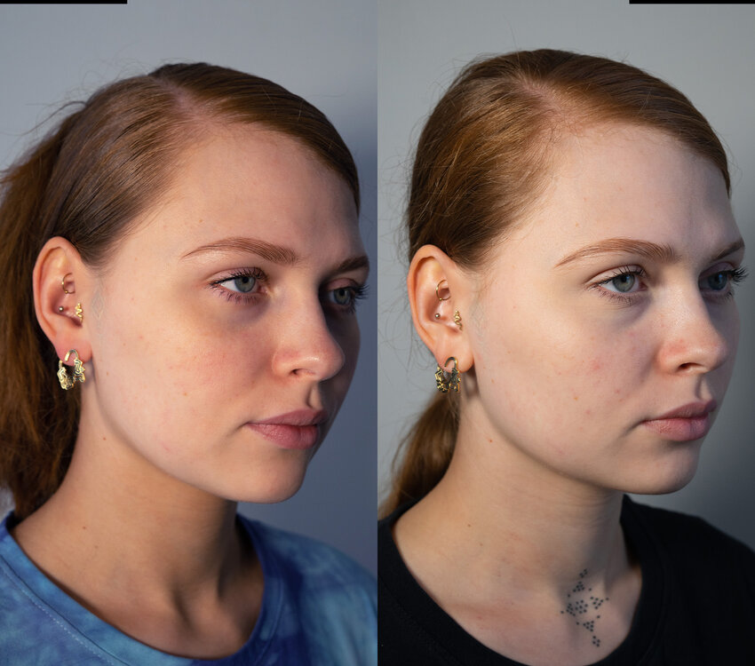 Hive Maskology PHOTON LED MASK