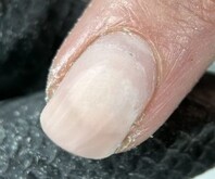 Pocket Lifting Troubleshooting