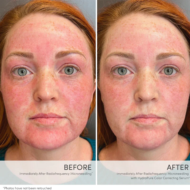 Jane Iredale HydroPure Color Correcting Serum - Green