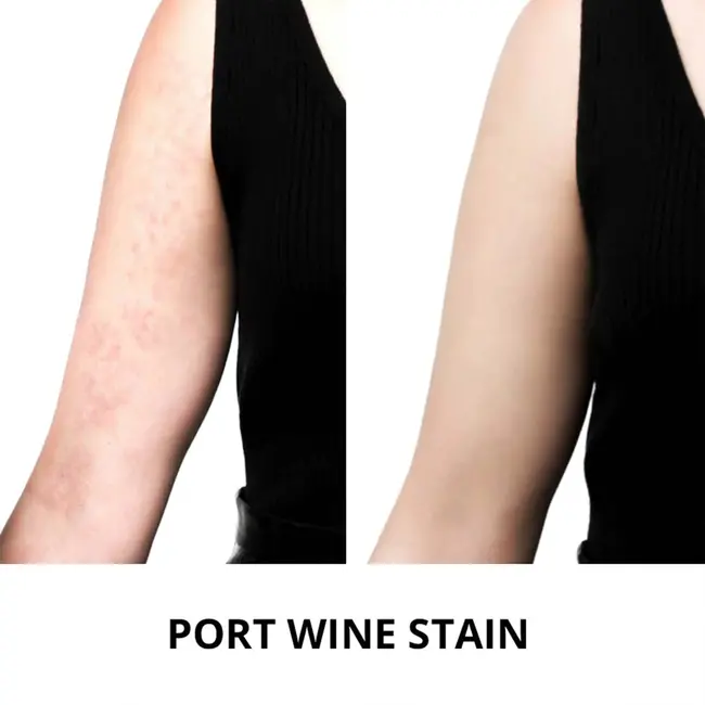 ARTDECO Concealer Camouflage Cream 7 Deep Whiskey 4.5 g