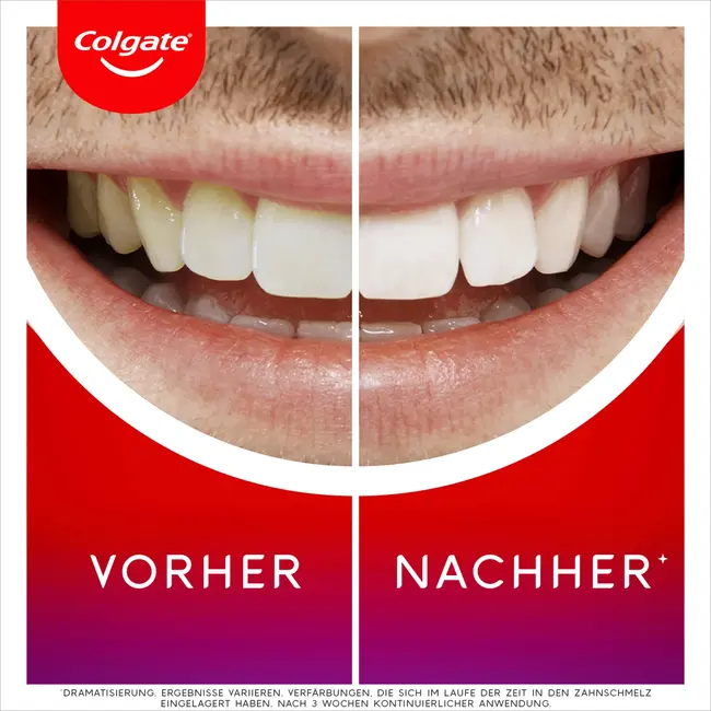 Colgate Whitening Serum Overnight 2.5 ml