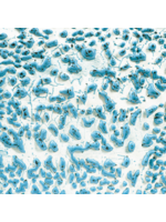 Amaco Speckled Teal Crawl