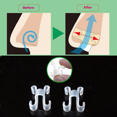 Generise Generise anti snurk neusvlinder