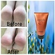 NuSkin Epoch Sole Solution NuSkin Epoch Sole Solution
