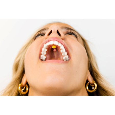 Myospots Passievrucht