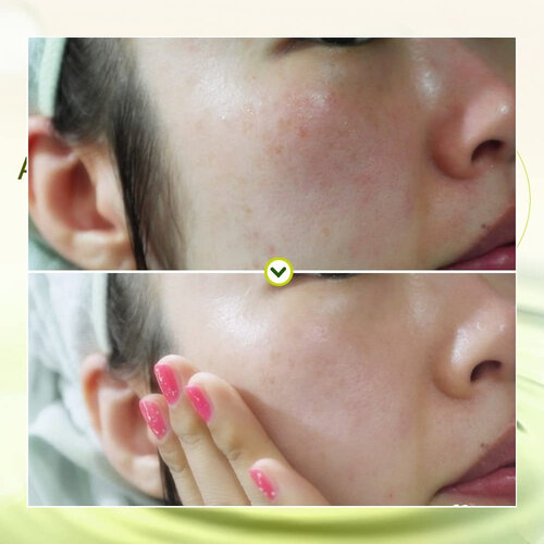 Elizavecca Hell-pore Galactomyces Pure Ample Elizavecca Hell-pore Galactomyces Pure Ample