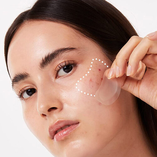 I Dew Care Timeout Blemish Patch Chin & Cheeks I Dew Care Timeout Blemish Patch Chin & Cheeks