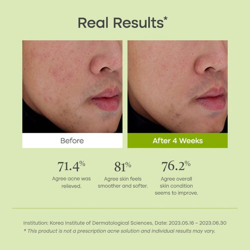 Purito Seoul Clear Code Superfruit Cleanser Purito Seoul Clear Code Superfruit Cleanser