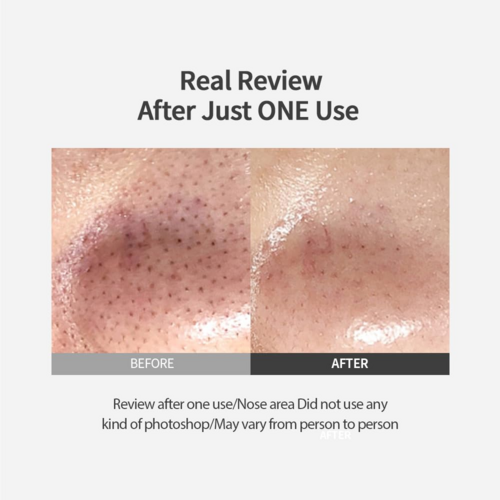 Sungboon Editor Blackhead Melting Clear Pad