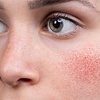 Trattamenti Viso Specifici
