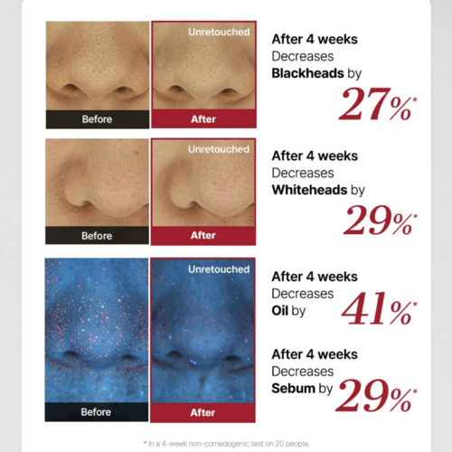 COSRX The AHA 2 BHA 2 Blemish Treatment Serum COSRX The AHA 2 BHA 2 Blemish Treatment Serum