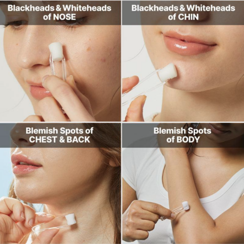 COSRX The AHA 2 BHA 2 Blemish Treatment Serum COSRX The AHA 2 BHA 2 Blemish Treatment Serum