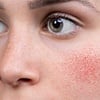Specific Skincare