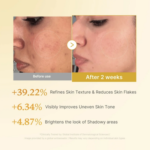 Medicube Kojic Acid Turmeric Resurfacing Toner Medicube Kojic Acid Turmeric Resurfacing Toner