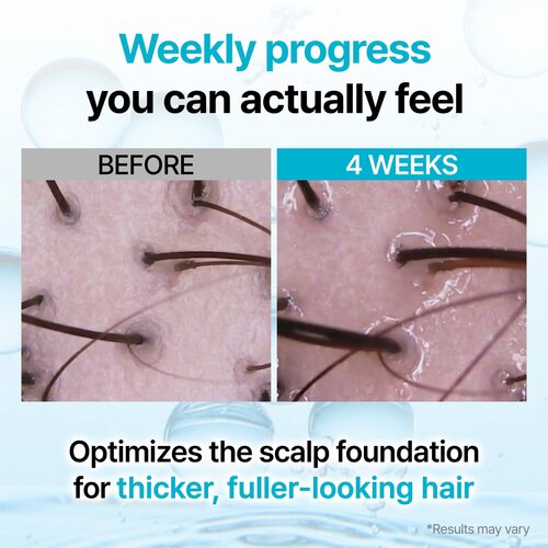 Growus Recover Therapy Hair Booster Serum Growus Recover Therapy Hair Booster Serum