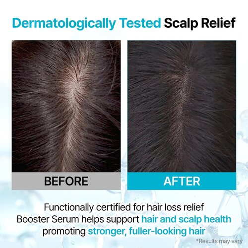 Growus Recover Therapy Hair Booster Serum Growus Recover Therapy Hair Booster Serum