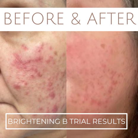 Jane Scrivner Brightening B