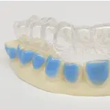 SleepPro Bleekset op Maat - Teeth Whitening Custom Set SleepPro Bleekset op Maat - Teeth Whitening Custom Set