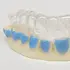 Bleekset op Maat - Teeth Whitening Custom Set Bleekset op Maat - Teeth Whitening Custom Set