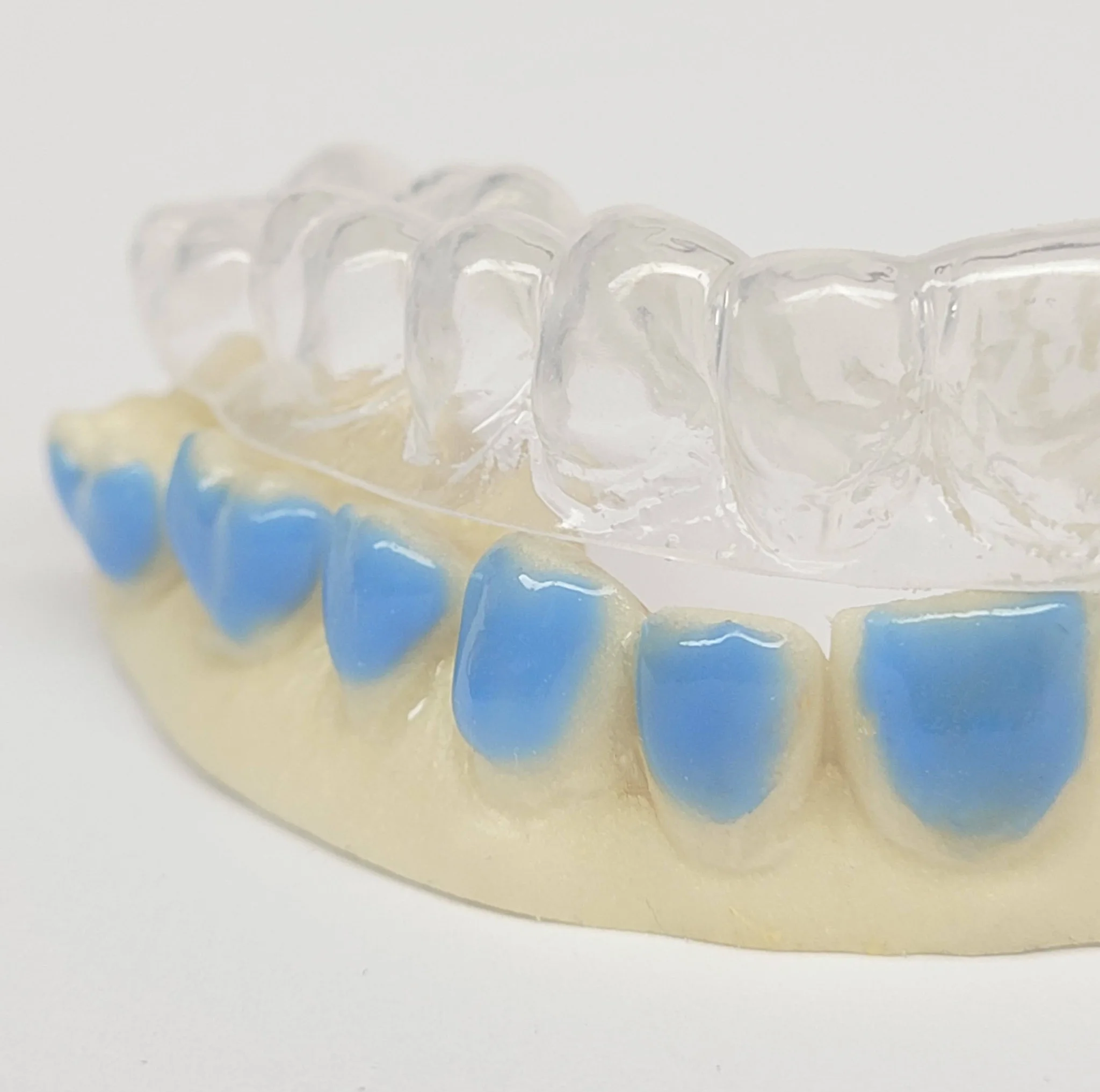 Bleekset op Maat - Teeth Whitening Custom Set