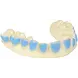 SleepPro Bleekbitje op Maat - Teeth Whitening Custom SleepPro Bleekbitje op Maat - Teeth Whitening Custom