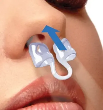 SleepPro Neusspreider - Neusdilatator  - 3 stuks