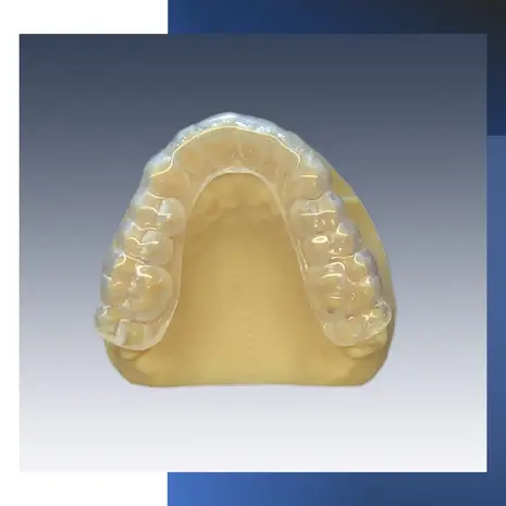 SleepPro Standard Plus Knarsbitje op maat – 3.0 mm SleepPro Standard Plus Knarsbitje op maat – 3.0 mm