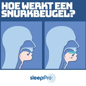 Hoe werkt een snurkbeugel
