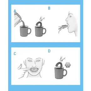Boil & Bite technologie Snurkbeugel