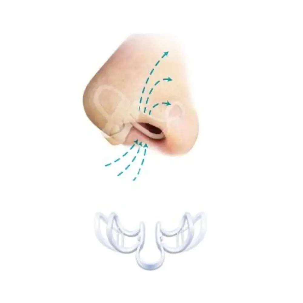 SleepRight Breathe Aid Neusspreider - 2 pack SleepRight Breathe Aid Neusspreider - 2 pack