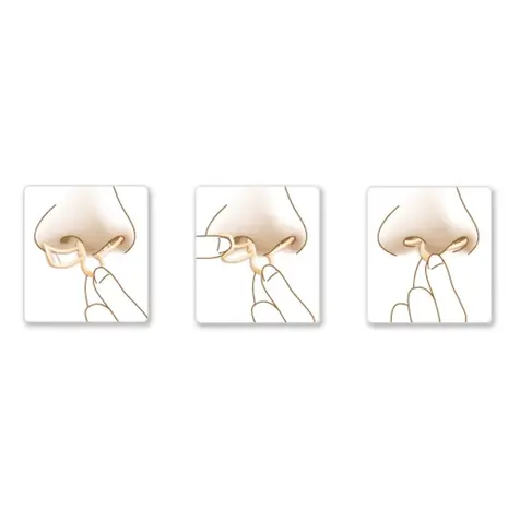 SleepRight Breathe Aid Neusspreider - 2 pack SleepRight Breathe Aid Neusspreider - 2 pack