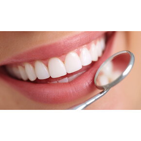 Wat zijn de voor- en nadelen van tanden bleken?