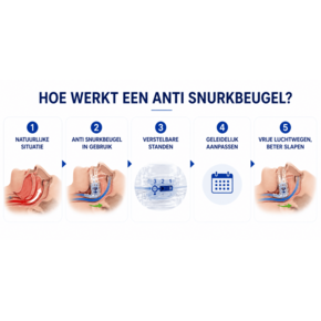 Snurkbeugels