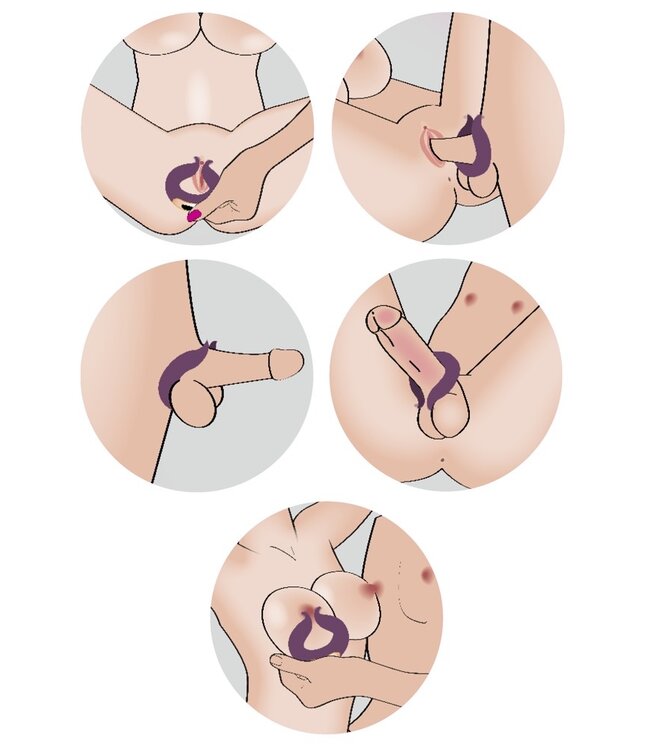 Two Motors Couple’s Ring