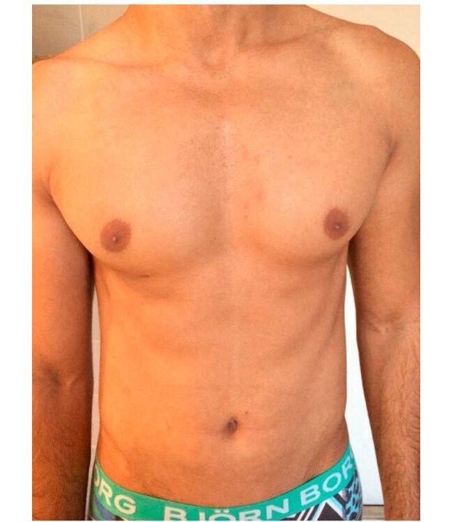 Intimate - Hair Removal  Powder