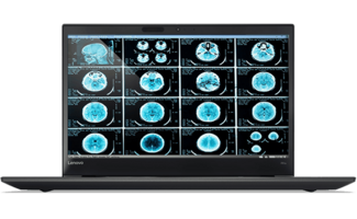 Lenovo Lenovo ThinkPad P51s - Intel® Core™ i7-7600U - NVIDIA® Quadro® M520 2 GB VRAM