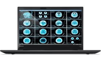 Lenovo ThinkPad P51s - Intel® Core™ i7-7600U - NVIDIA® Quadro® M520 2 GB VRAM
