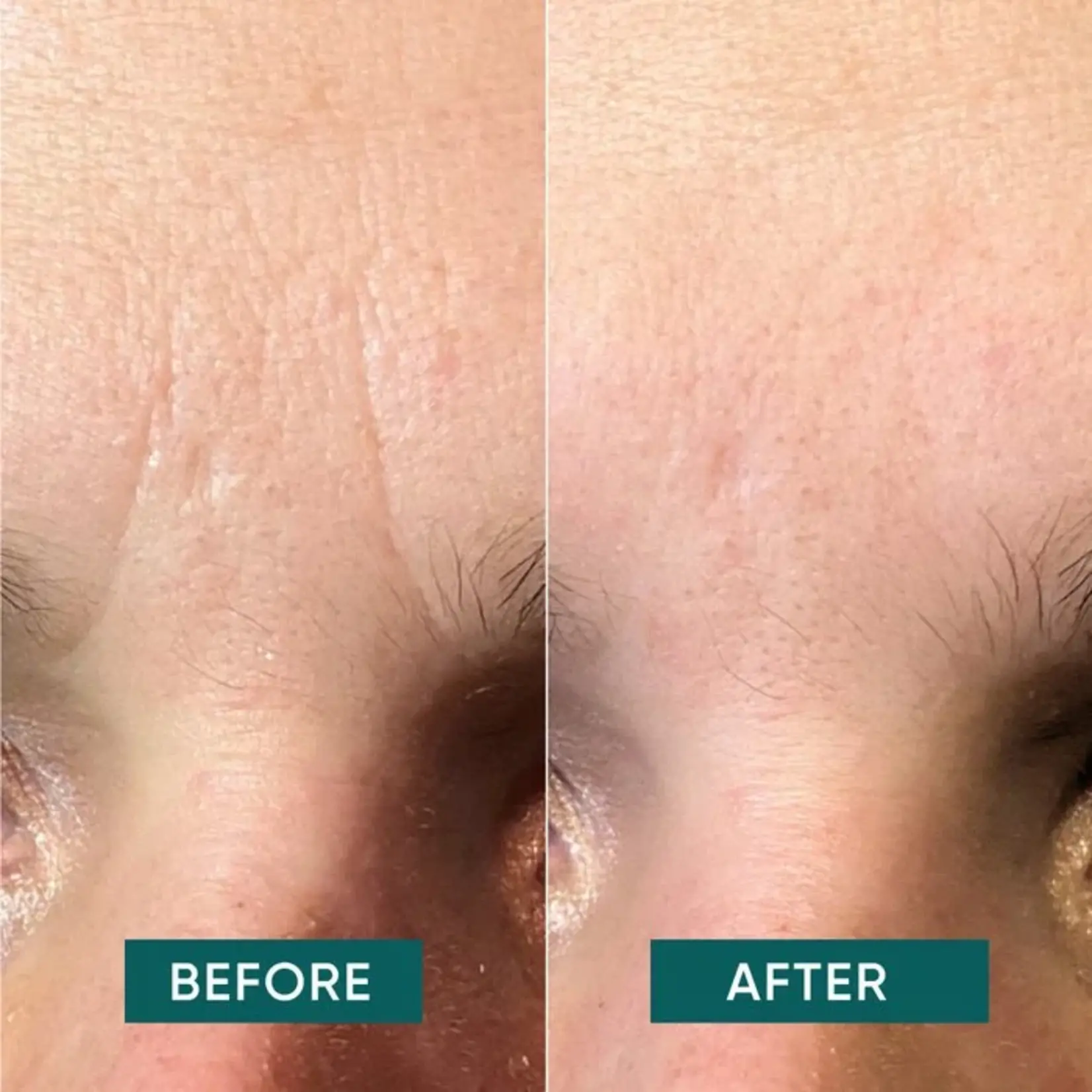 Apricot Frown Patches - down the frown