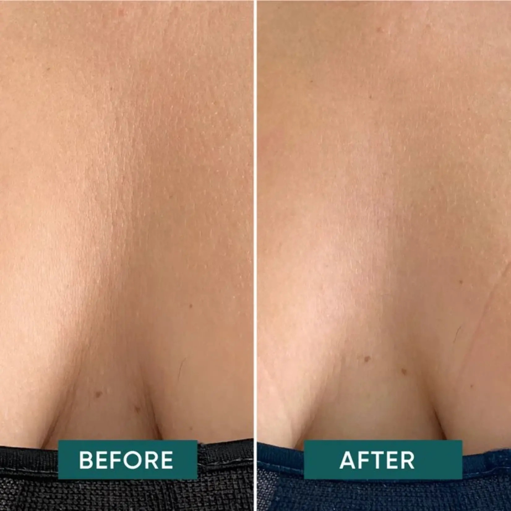 Apricot Décolleté Patch - one calm away