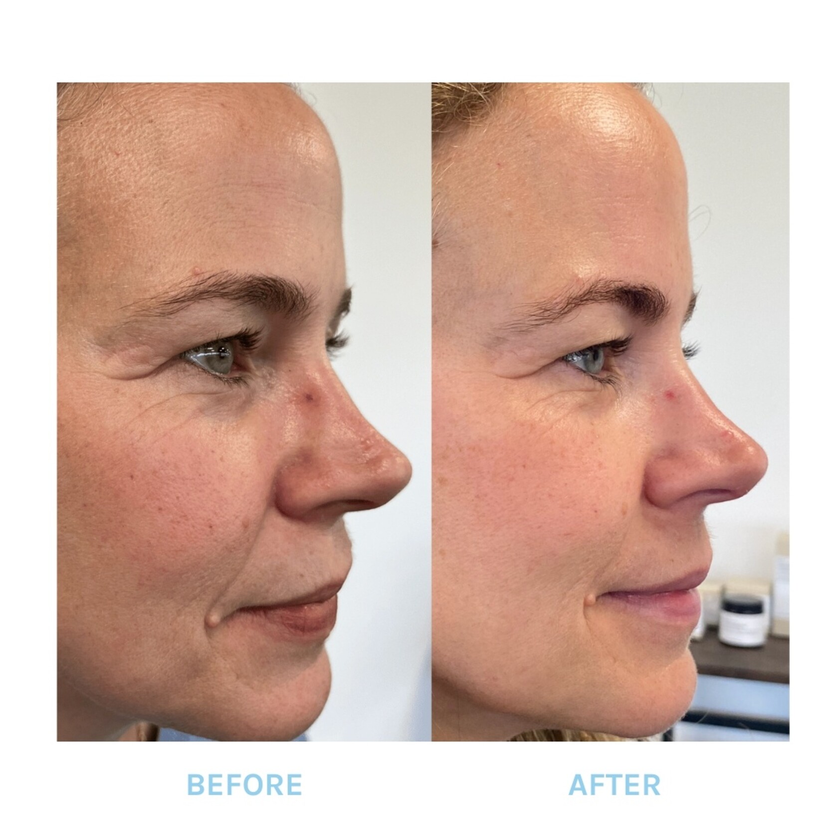 Evolve Organic Beauty Age Defying Lifting Serum