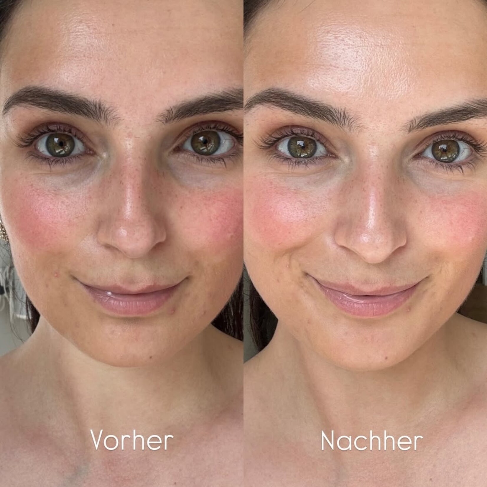 Apricot Eye Patches - Glow getter