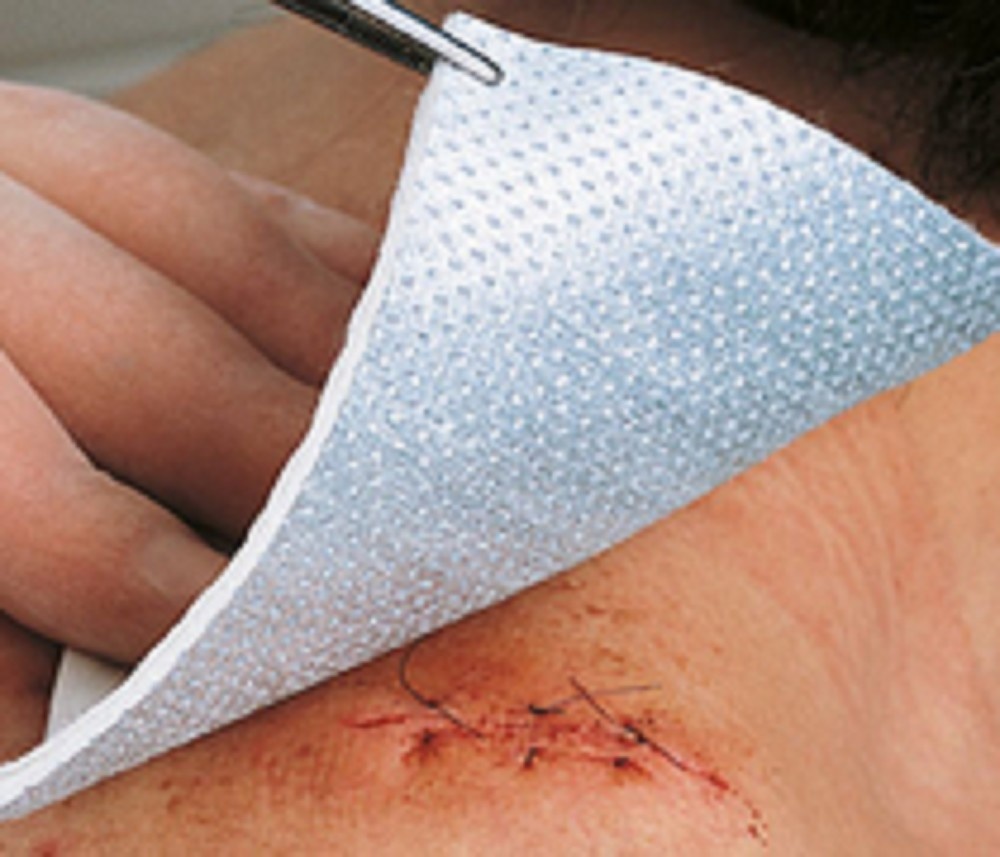 Metalline nw kompres 8 x 10 cm steriel